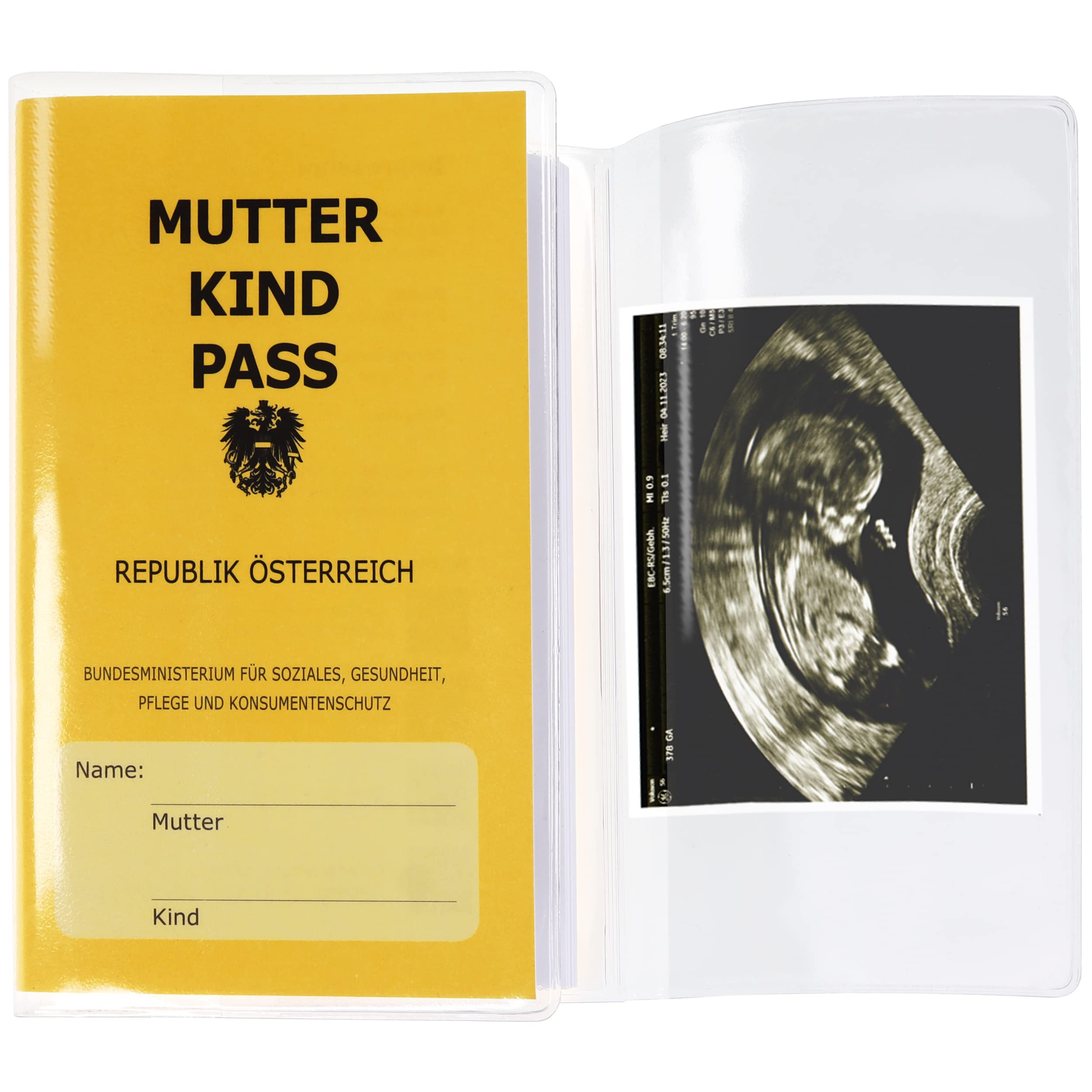 Olgs Mutter-Kind-Pass Hülle | Transparente MKP Schutzhülle aus Österreich | Mit Extrafach für Ultraschallbilder | Mutterkindpass Organizer | Blanko Etui - 1 Stück Angebot bei HelloDeals