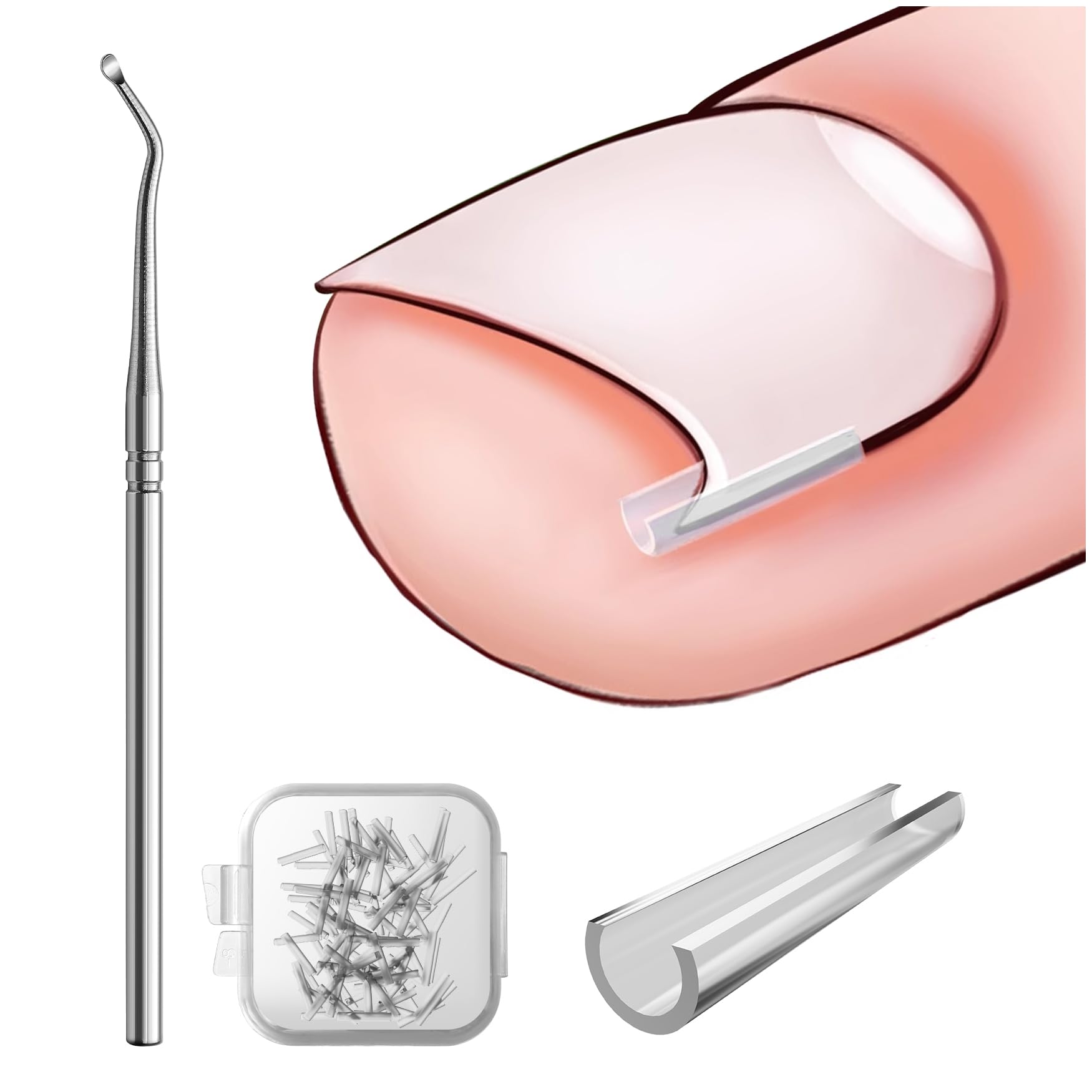BEZOX Set zur Korrektur eingewachsener Zehennägel - 40 Stück schmerzfreie Zehennagelglättungsstreifen mit Zehennagelheber - einfaches Werkzeugset für eingewachsene Zehennägel silber Angebot bei HelloDeals