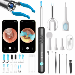 BEBIRD R1 Ultra Ohrenschmalz Entferner Kamera, Ohrenreiniger mit Otoskop für Zuhause, Komplett-Set mit Sichtbarer Dropper & Pinzette, Für Ohr & Nase & Rachen Untersuchung der Familie-Schwarze Angebot bei HelloDeals